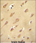 OR5L2 Antibody (N-term)